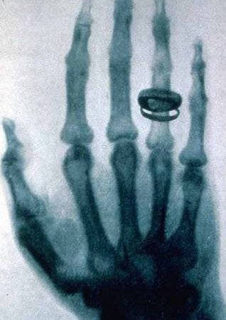 5 січня 1895 року. Відкриті рентгенівські промені