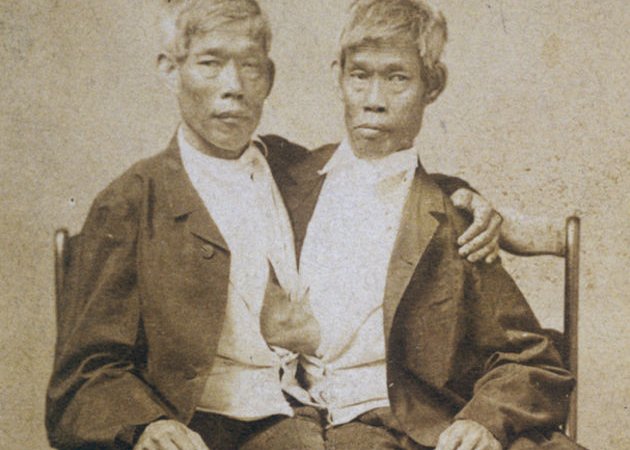 17 січня 1874 року. Померли Чанг і Енг БАНКЕРИ.
